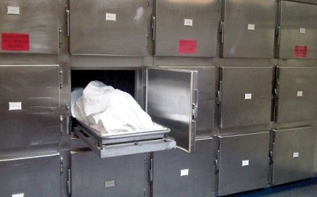 جراحی  « پیکرتراشی » جان مرد جوان را  گرفت